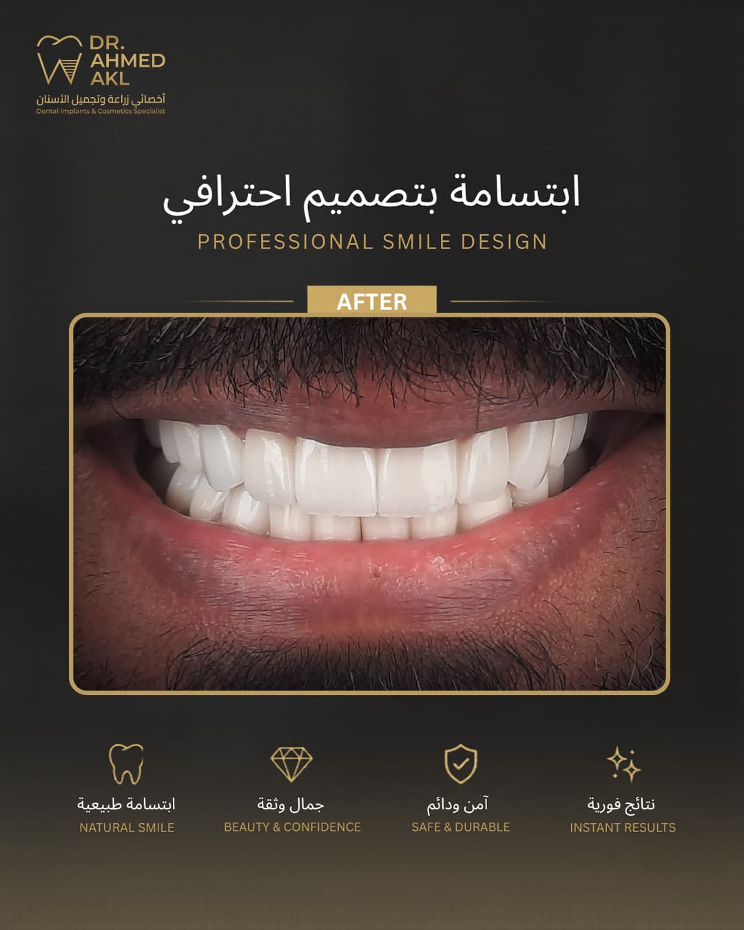 حالة 30